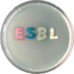 an image of the Extended-spectrum beta-lactamase bacteria in a lab environment